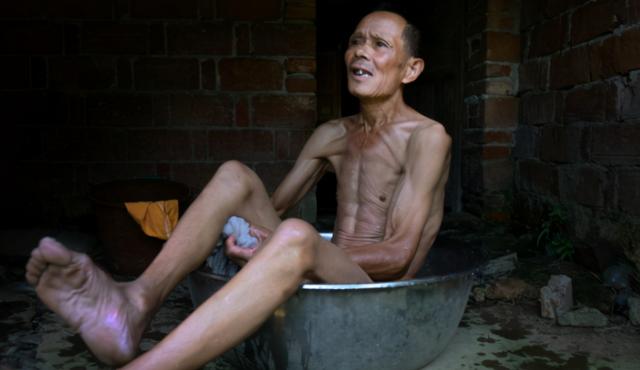 这3种遍地可见的草药是肝癌的救星，一种民间偏方却在销声匿迹