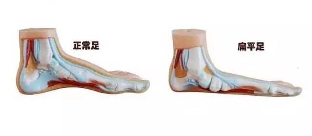 「超级宝妈」天热了,宝宝到底能不能光脚?原来我们一直都错了