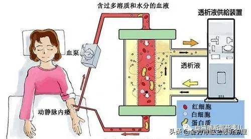 血液净化在急诊的临床应用