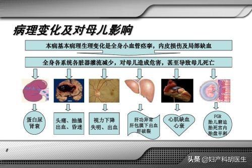 [你的育儿经]突然水肿、头晕，恶心？医生说，孕妈妈们当心这种疾病