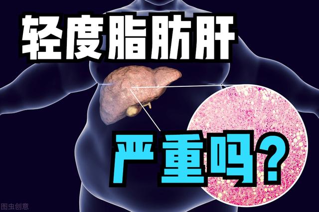 轻度脂肪肝，是很严重的肝病吗？要怎么做？医生告诉你实情