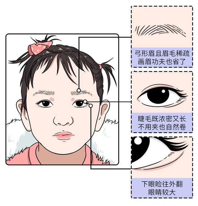 长得好看未必是件好事，可能是这种“遗传病”，不能高兴得太早