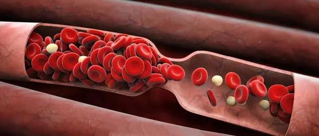 28岁小伙上肢缺血险坏死，医生以大隐静脉移植重建血管通路让他“绝处逢生”