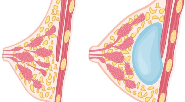 「你的育儿经」COVID-19疫情期：如何预防哺乳期乳腺炎？