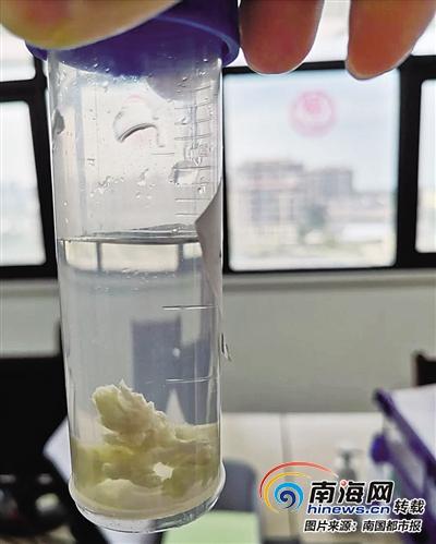 南海网：三亚一岁男童反复咳嗽1个月导致肺气肿 原是鸡肉卡在支气管