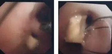 [你的育儿经]青岛2岁男孩反复咳嗽，父母没及时带其去医院！医生：轻则感染，重则致命！