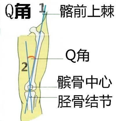 膝关节疼痛、经常打软腿？一种自测方法找原因，四个动作练起来