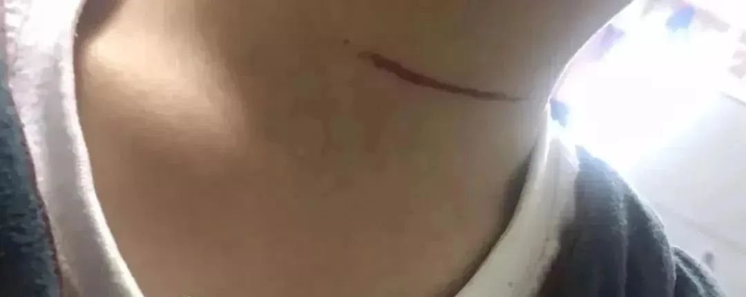 精彩好文推荐■因为这个东西，夫妻双双截肢！盘点春天的“夺命杀手”，家长一定要留意！