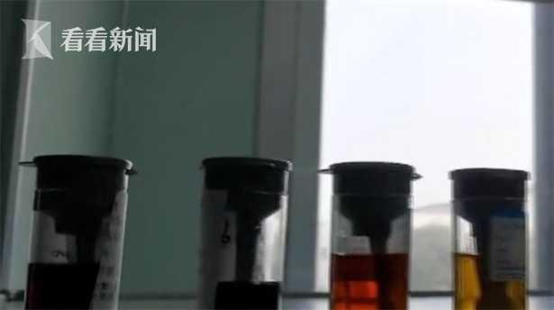 「你的育儿经」娃高烧爸妈怕被隔离不敢送医！结果孩子尿出酱油色