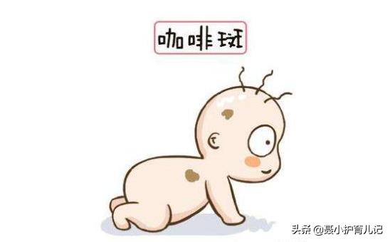 你的育儿经|新生儿屁股淤青怎么回事？如果属于这三种“胎记”记得看医生