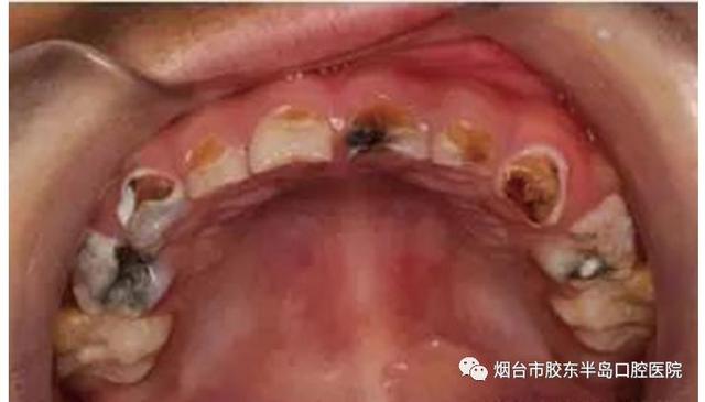 #你的育儿经#孩子不懂大人不在乎 有可能会影响孩子一生