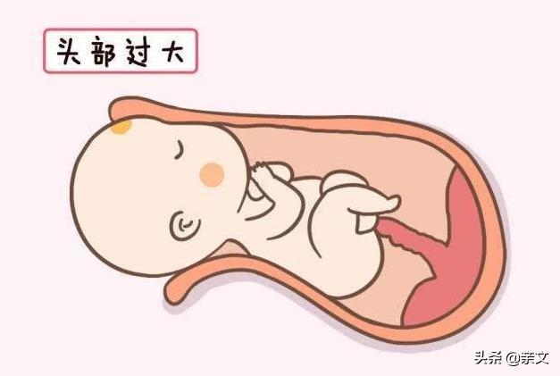 安全港|宝宝头那么大，如何从产道出来？看完才明白母亲伟大
