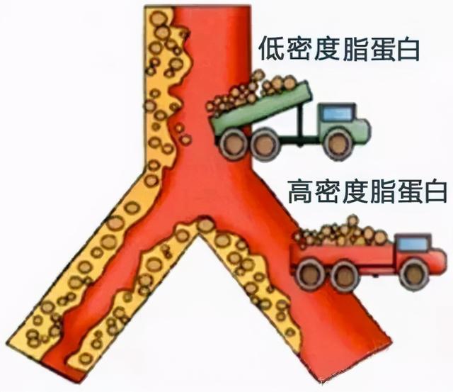 低密度蛋白高了，血管已经“堵”了吗？医生一讲，全明白了