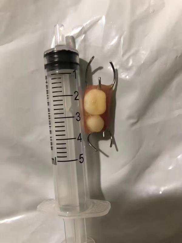 阿姨|洗漱时不小心把假牙吞了，杭州阿姨慌了：