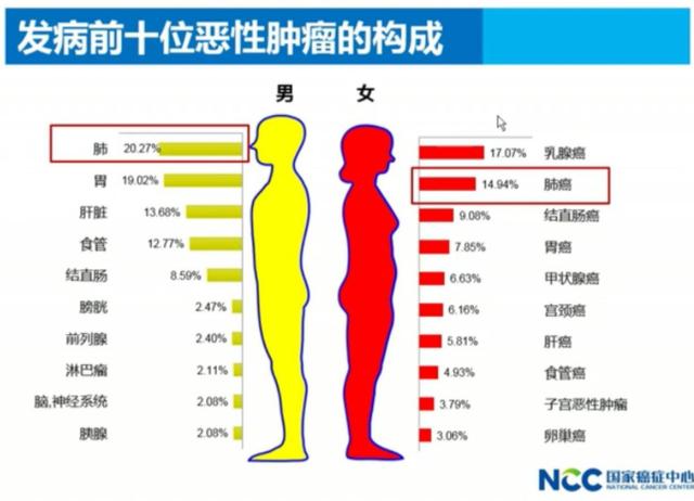 中山七院胸外科成功救治食管癌、肺癌双原发患者