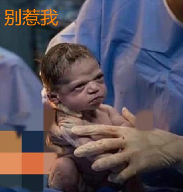 你的育儿经▲剖腹产宝宝出生后“眼神杀”太霸气，我不哭，网友：惹不起