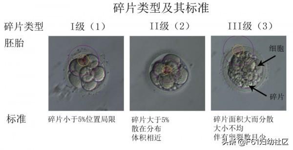 生活矜持点|试管婴儿胚胎评分和胚胎移植、冷冻、丢弃标准