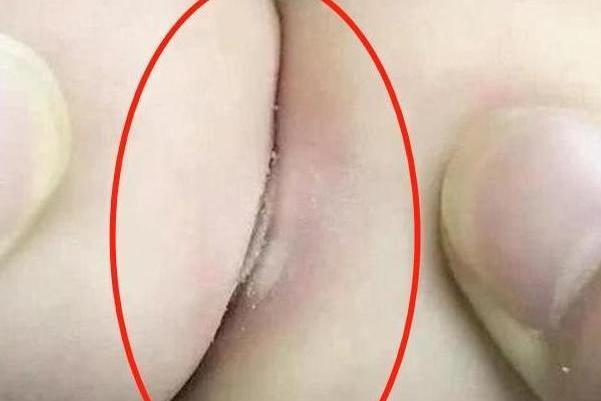 [你的育儿经]6个月宝宝，被奶奶带成“莲藕娃娃”，医生看后：腿保不住了！
