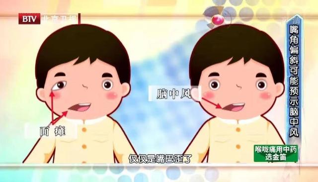 舌头|吃饭时总咬到舌头，是想吃肉吗？背后隐藏的问题可不小……
