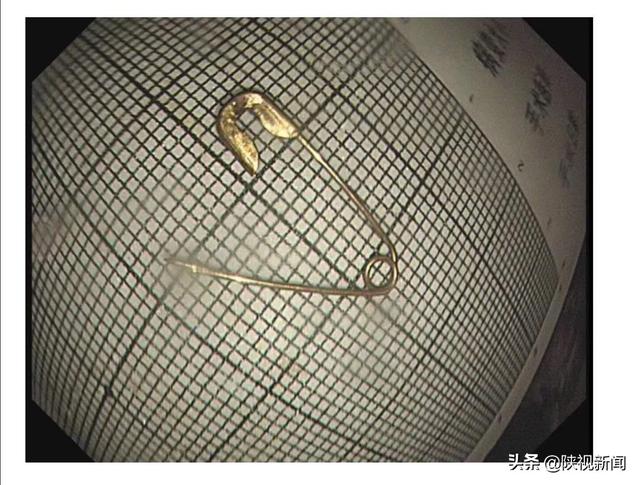 你的育儿经|太吓人！固定蚊帐的“别针”掉在床上后，被10个月大的宝宝误吞