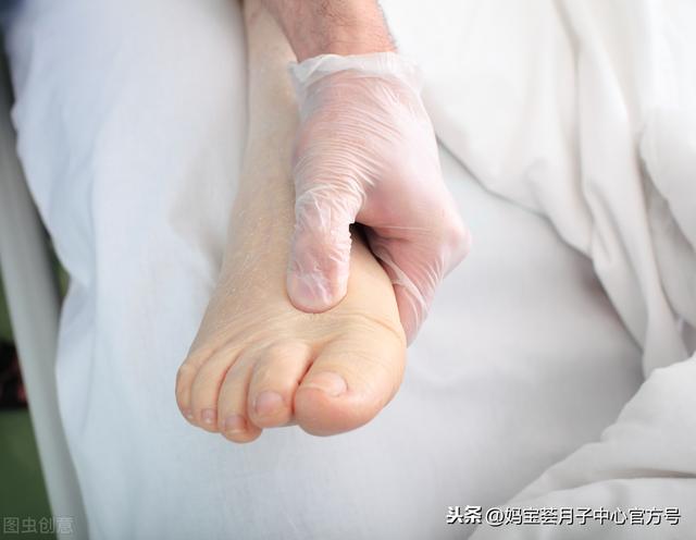 避风港|海南月子中心：孕妇孕晚期水肿是为什么？怎么消除？