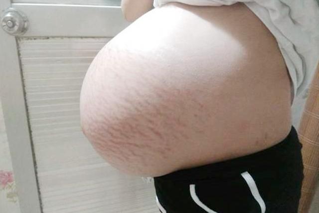 「你的育儿经」为什么“悬浮肚”的产妇不能顺产？两大难关难突破，还有尴尬等候