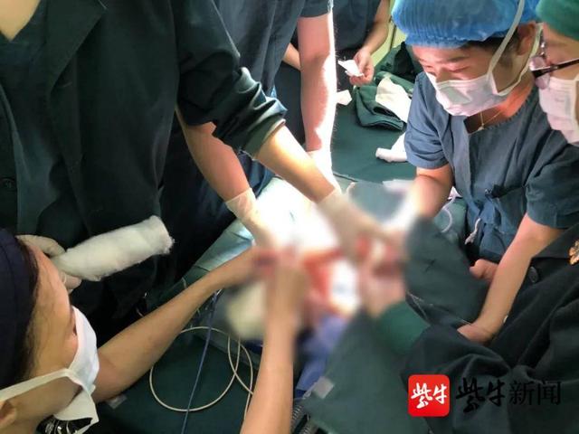 扬眼|出生仅3天，国内年龄最小的重度肾积水宝宝手术成功了