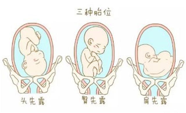 「超级宝妈」可不可以顺产，并不是你说了算，医生：需要达到5个标准