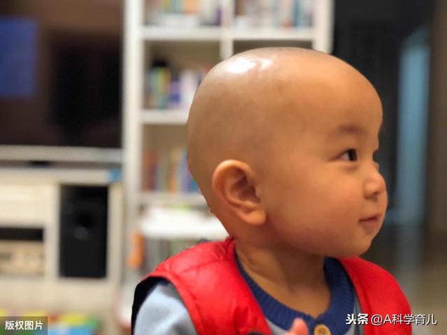 你的育儿经|夏天来了，你还在给宝宝剃光头吗？