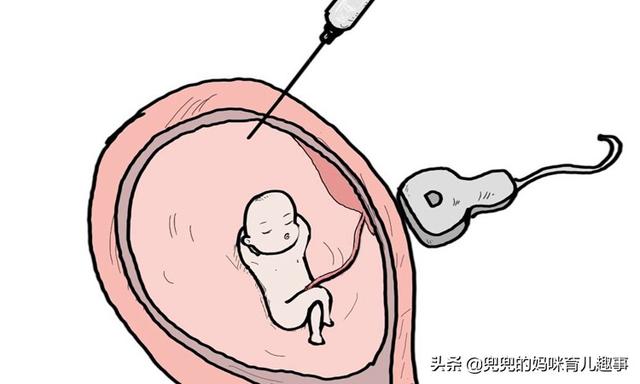 「超级宝妈」孕期准妈妈如果遇到这些情况，就自己拿主意吧，医生也帮不了你！