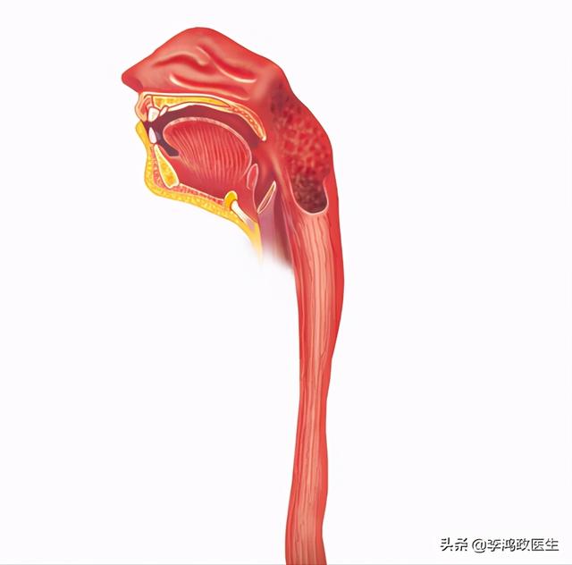 女子心口刺痛诊断食管癌，术后复查怀疑胆囊癌：一切决定交给丈夫