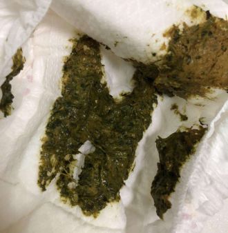 「暖先生格调」宝宝拉绿便就是奶粉的“锅”？饥饿、辅食......这些都可能，附图干货拿去！