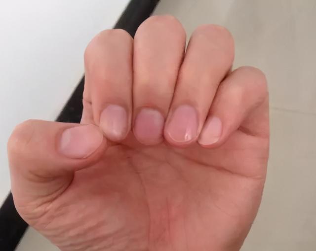 为什么很多人指甲上有月牙，有的人却一个都没有？科学解释来了