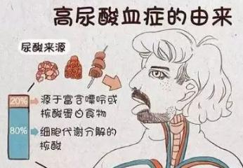 痛风患者的蛋白质摄入