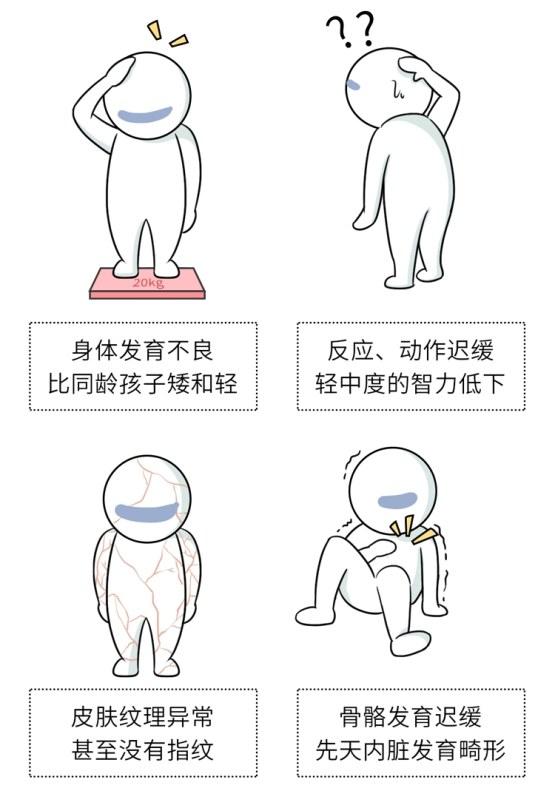 长得好看未必是件好事，可能是这种“遗传病”，不能高兴得太早