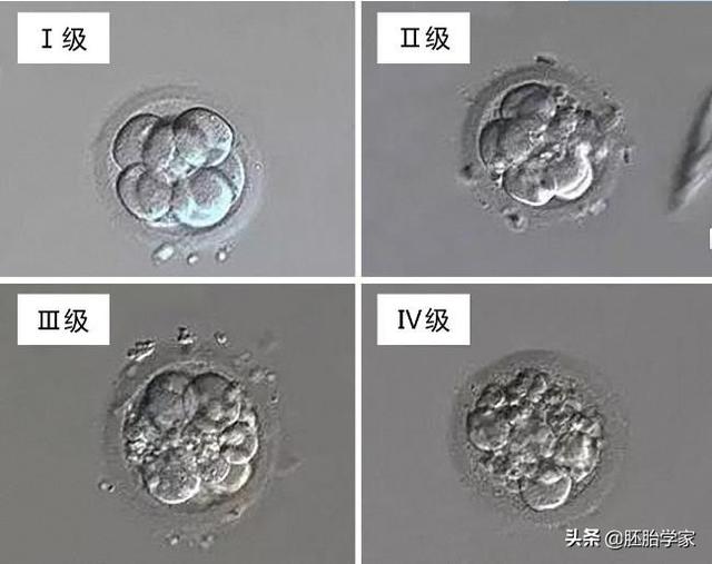 『超级宝妈』试管婴儿周期中准爸准妈面临的艰难抉择,移植囊胚还是D3胚？