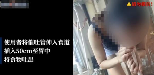 减肥|图啥呢？为了减肥将“仙女管”插入胃里50厘米……这些危害想过吗？