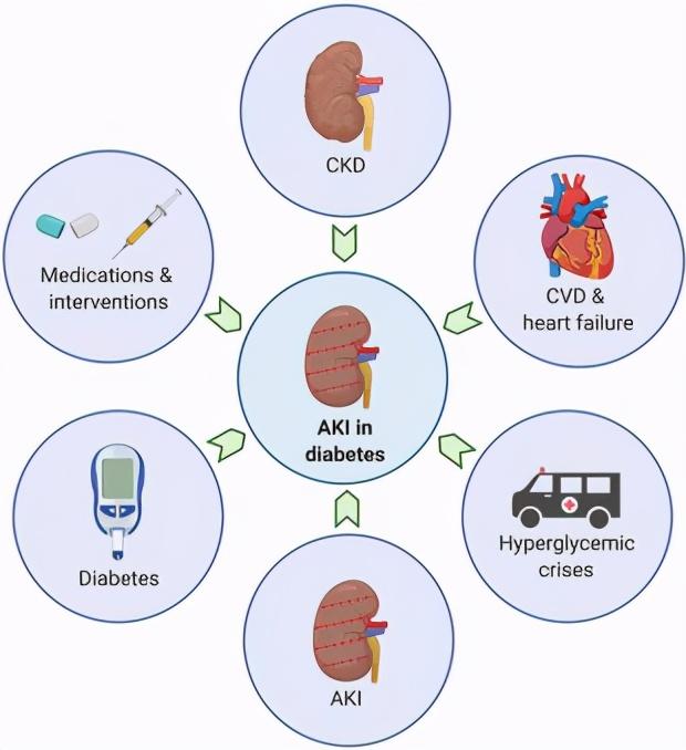 急性肾损伤：未得到重视的糖尿病并发症