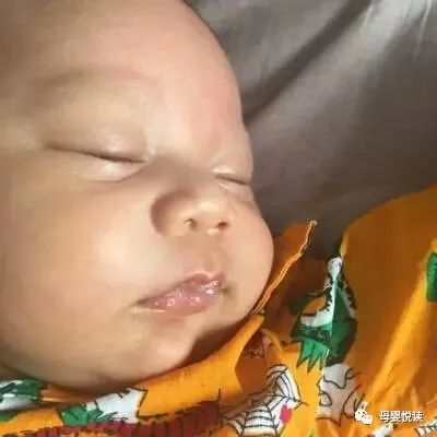 『雾里看小花』新生儿这23个正常与病态现象
