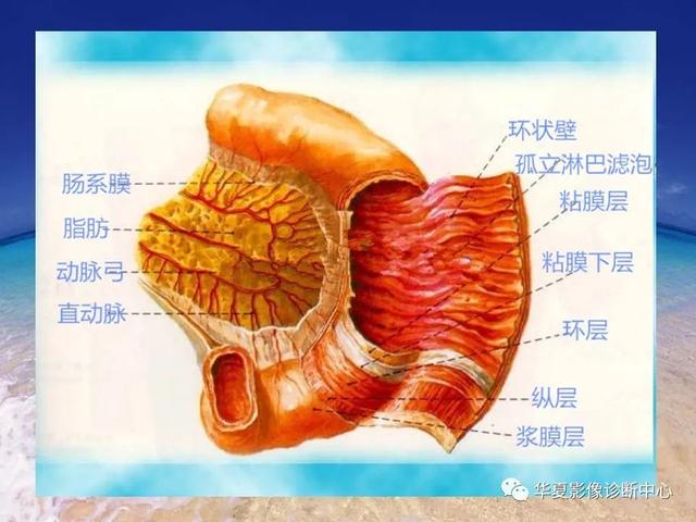 消化道穿孔的CT诊断