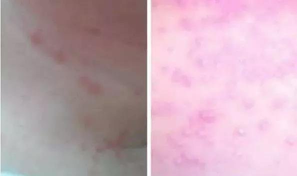 安全港|阜新阳光大姐｜|最容易误判的新生儿常见病详解