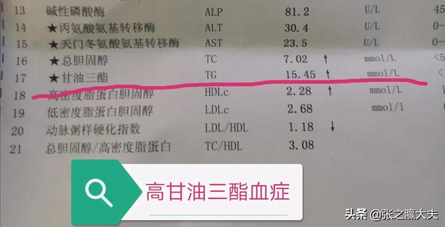 甘油三酯高、胆固醇高，是病吗？如何治疗？医生说：2类食物少吃