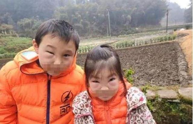 你的育儿经■熊孩子兄妹误捅马蜂窝，脸肿得爹妈不敢认，网友：不该笑但忍不住