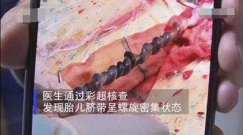 「你的育儿经」遇到调皮的“麻花宝宝”，惊喜惊吓双倍奉上，宝爸：是个人物