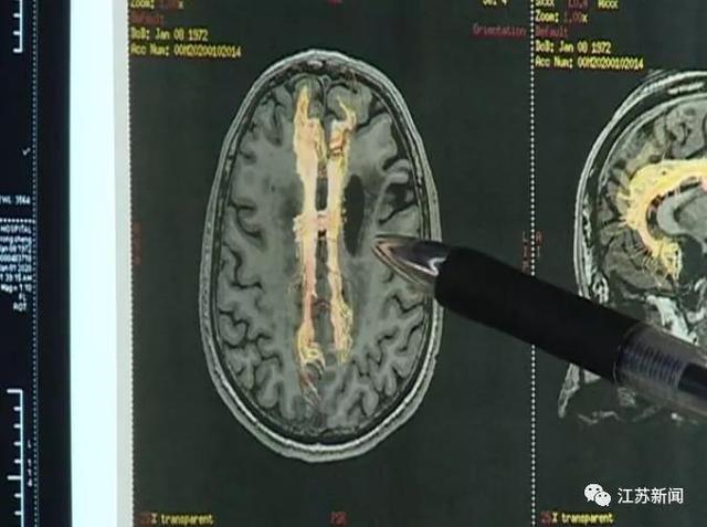 中毒|曼陀罗种子能祛痘？有人吃了结果住进ICU，这些偏方太害人了