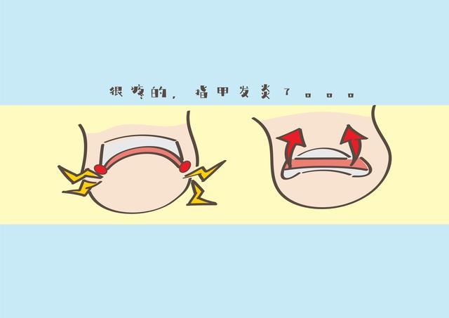 超级宝妈|咬手指真的只是习惯吗？家长别再大大咧咧了，小行为会造成大影响