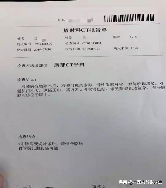 58岁孟先生查出多个肺结节，除了手术切除，还有什么办法？