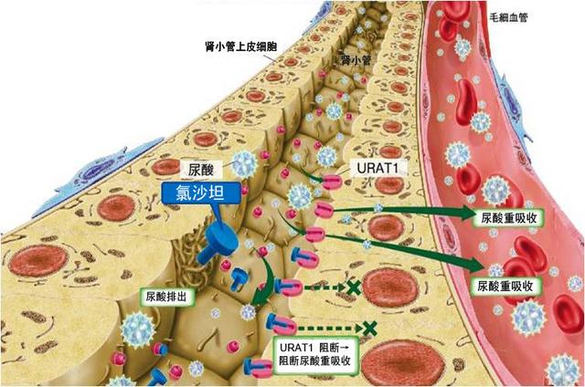 三级高血压吃厄贝沙坦、氨氯地平三周，低压高、还有痛风怎么办？