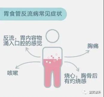 食管|经常反酸烧心是“门”没关紧