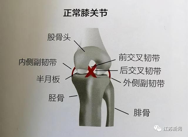 膝关节|37岁男子膝盖疼，一查竟中招严重“老年病”！究竟是啥惹的祸？